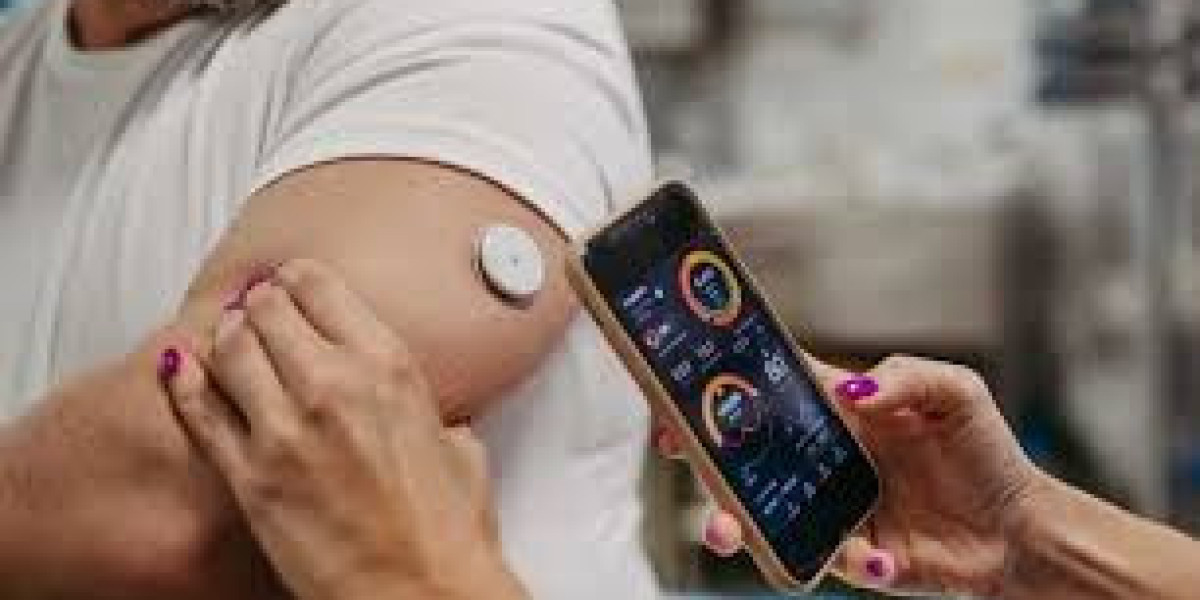 Global CGM Market Size And Forecast Report 2024-2023