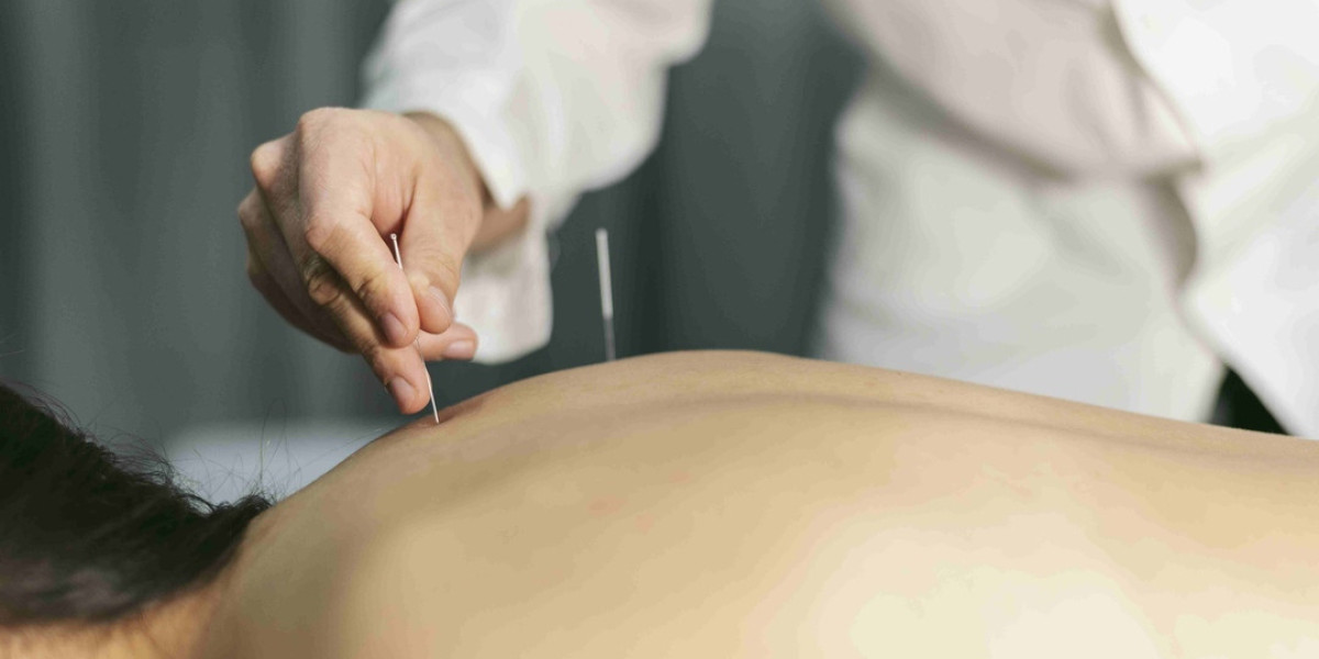IVF Newport Beach CA – Integrative Fertility Care