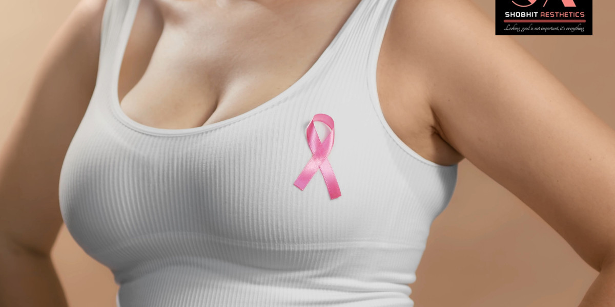 Breast Implant Surgery in Delhi: A Complete, Expert Guide